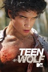 Teen Wolf – Farkasbőrben (2011–2017)